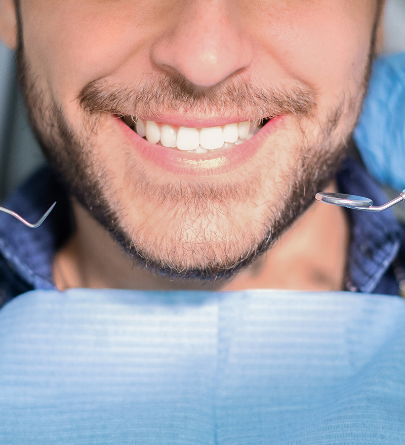 Tus Especialistas en blanqueamiento dental en Valencia