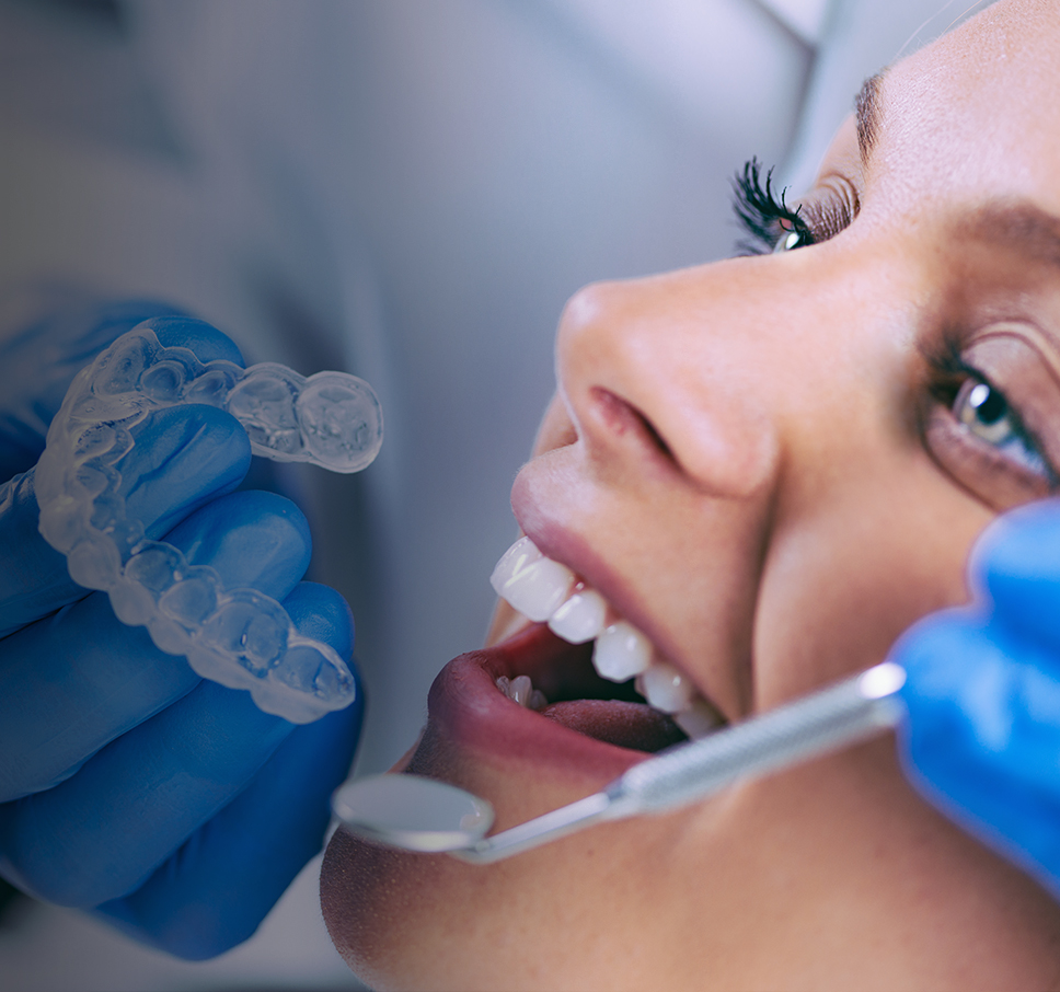 Especialistas en blanqueamiento dental en Valencia