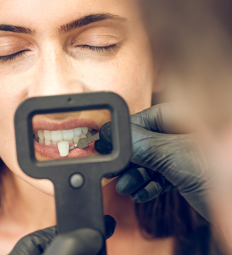 Clínica Especialistas en blanqueamiento dental en Valencia