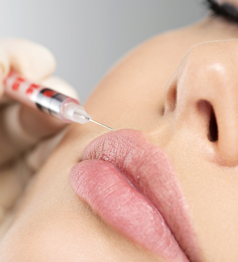 Aumento de Labios en Valencia