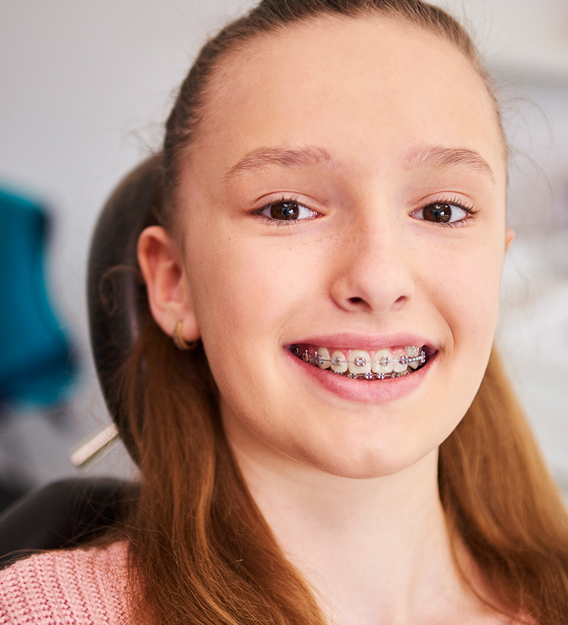 Ortodoncia en Valencia