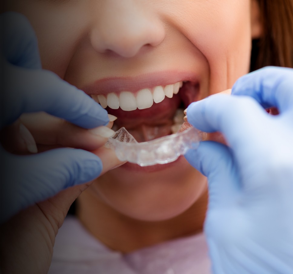 Ortodoncia en Valencia