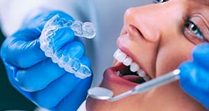 Evitar dientes amarillos con blanqueamiento